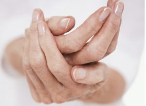 senior's hands with arthritis